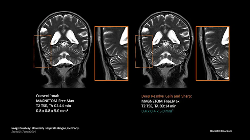 Deep Resolve Gain and Sharp Scans
