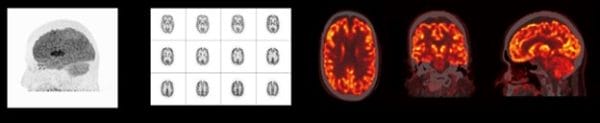Four brain scan images displayed in a row, showing different imaging techniques such as PET and MRI scans.