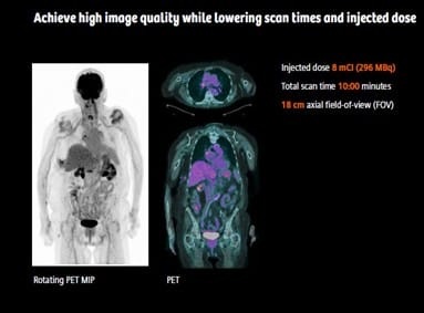 Siemens High Performance Trinion Imaging Example