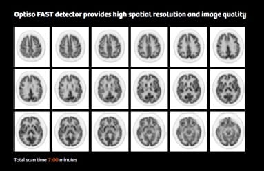 Siemens High Performance Trinion PET/CT Imaging